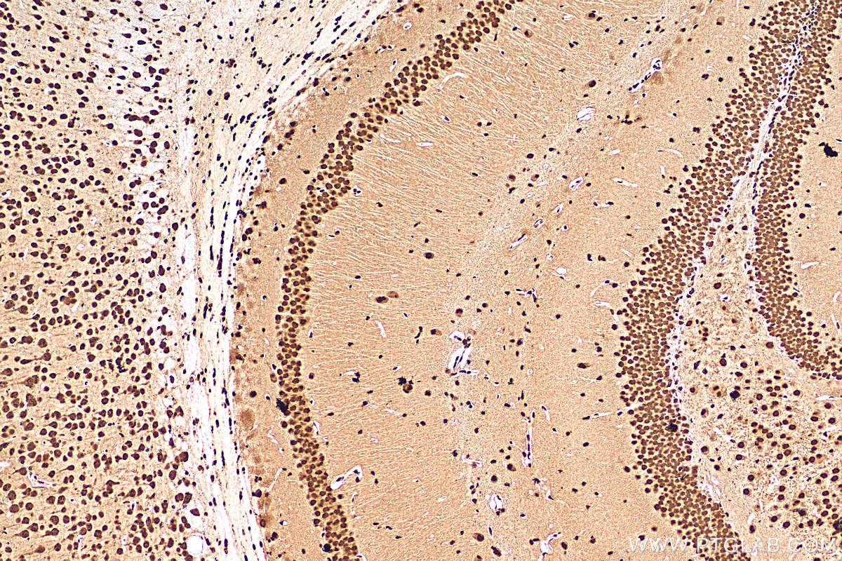 IHC staining of mouse brain using 11570-1-AP