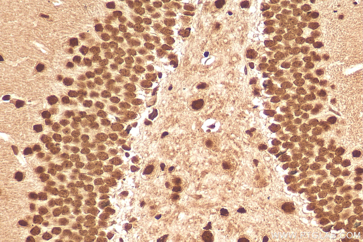 Immunohistochemistry (IHC) staining of mouse brain tissue using FUS/TLS Polyclonal antibody (11570-1-AP)