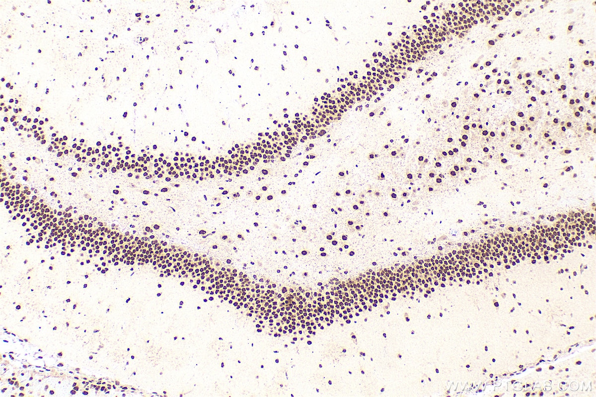 Immunohistochemistry (IHC) staining of rat brain tissue using FUS/TLS Polyclonal antibody (11570-1-AP)
