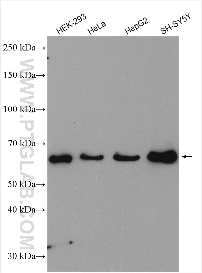Western Blot (WB) analysis of various lysates using FUS/TLS Polyclonal antibody (11570-1-AP)