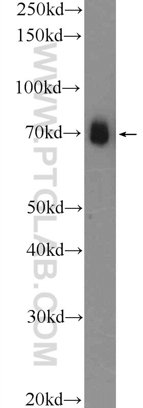 FUS/TLS Polyclonal antibody