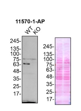 Western Blot (WB) analysis of HeLa cells using FUS/TLS Polyclonal antibody (11570-1-AP)