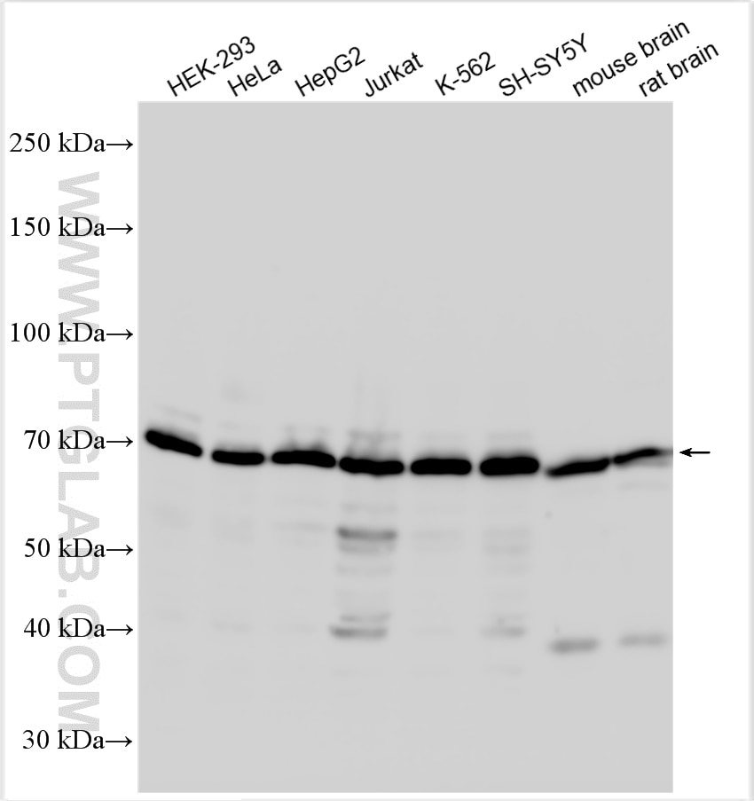 Western Blot (WB) analysis of various lysates using FUS/TLS Polyclonal antibody (11570-1-AP)