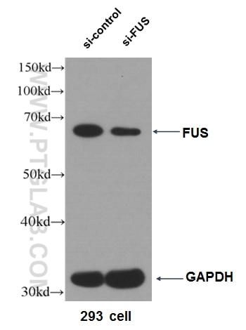 Western Blot (WB) analysis of HEK-293 cells using FUS/TLS Polyclonal antibody (11570-1-AP)