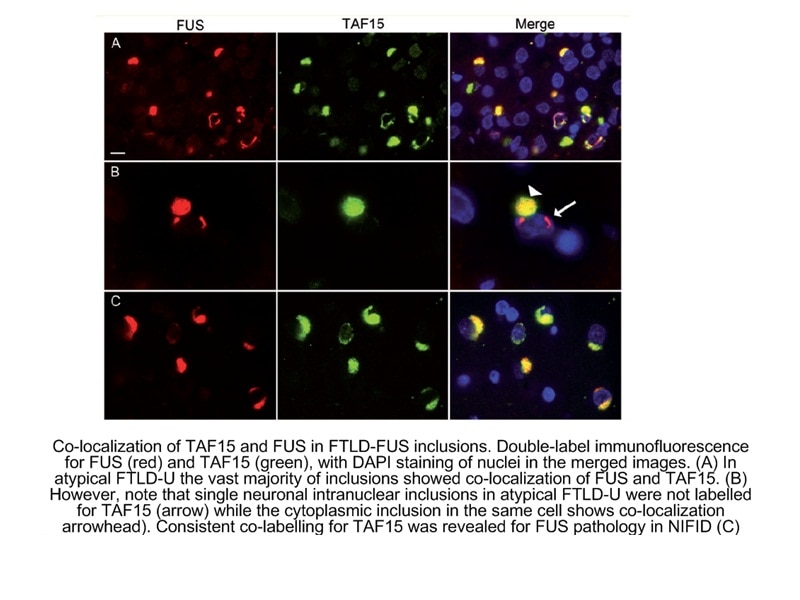 FUS/TLS Monoclonal antibody