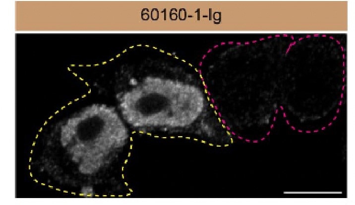 Immunofluorescence (IF) / fluorescent staining of HeLa cells using FUS/TLS Monoclonal antibody (60160-1-Ig)