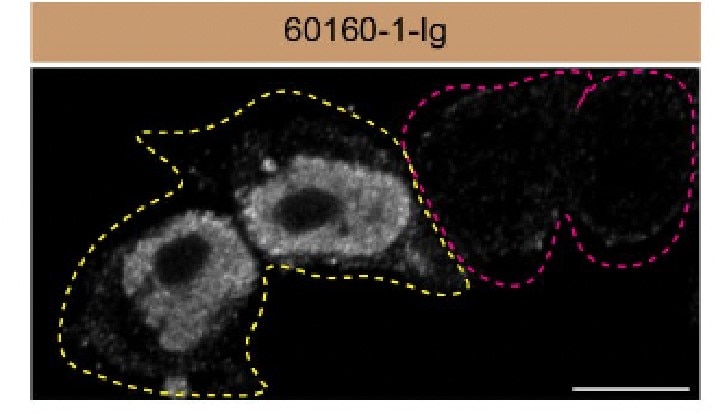 IF Staining of HeLa using 60160-1-Ig