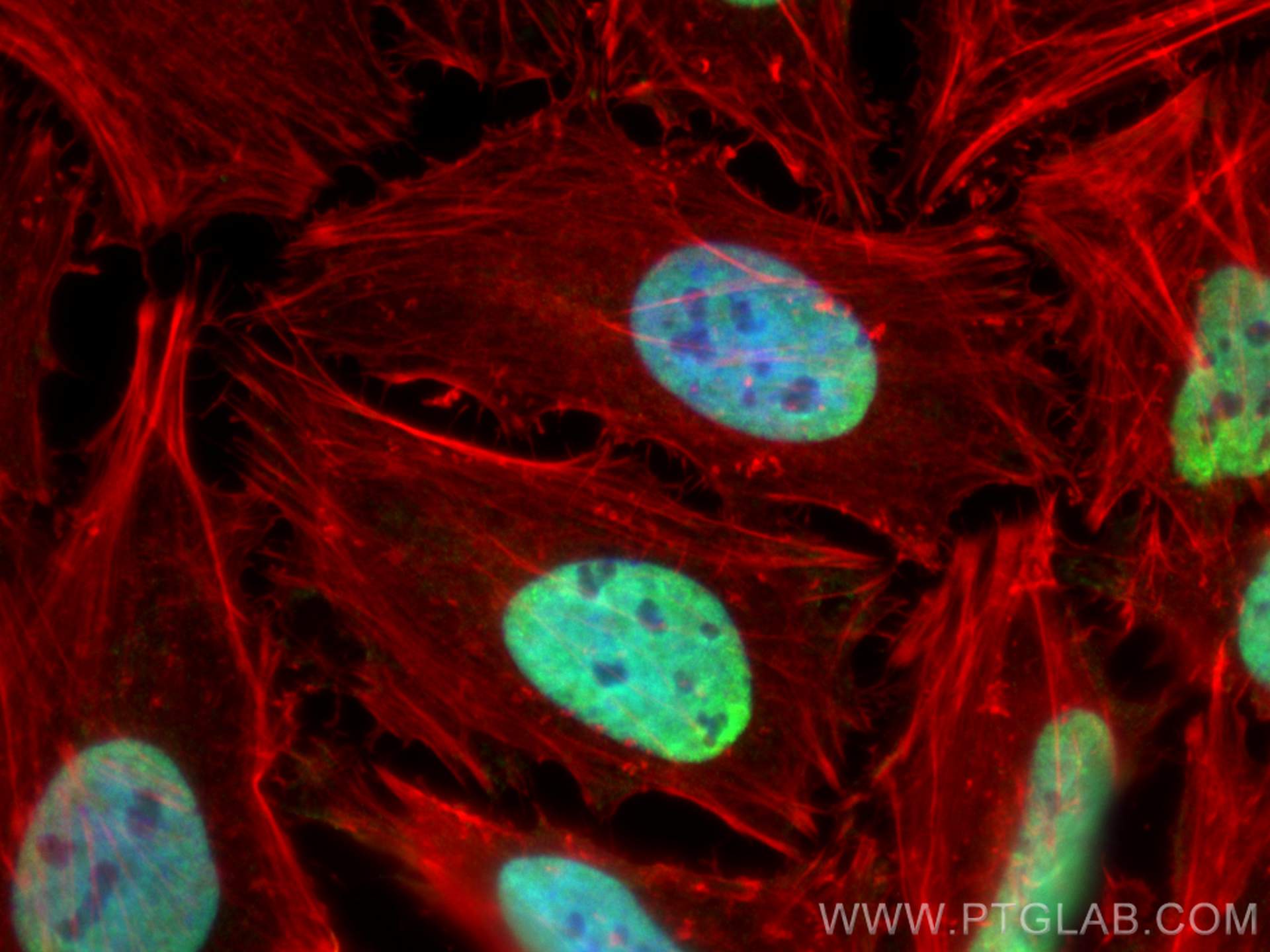 Immunofluorescence (IF) / fluorescent staining of HeLa cells using FUS/TLS Monoclonal antibody (60160-1-Ig)