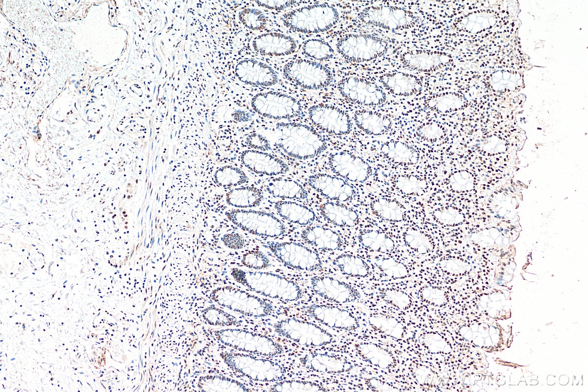 Immunohistochemistry (IHC) staining of human colon tissue using FUS/TLS Monoclonal antibody (60160-1-Ig)