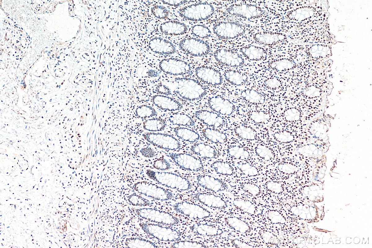 IHC staining of human colon using 60160-1-Ig