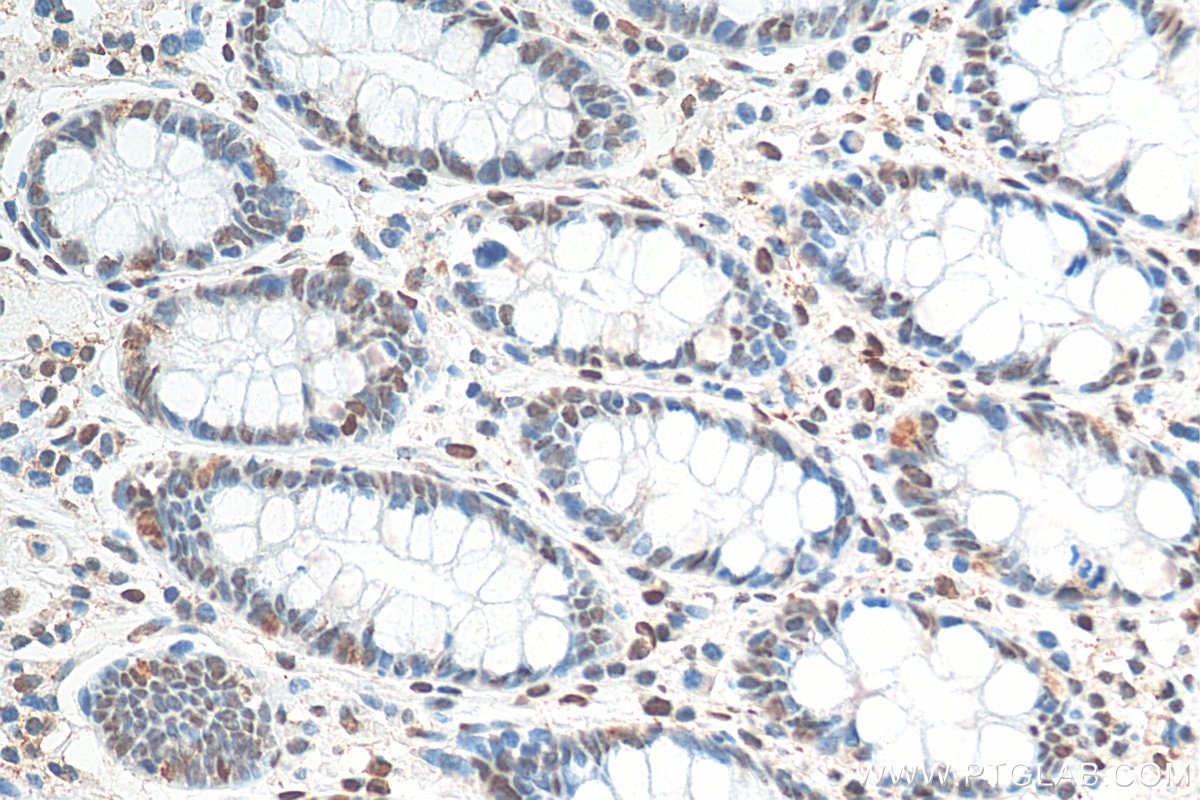 Immunohistochemistry (IHC) staining of human colon tissue using FUS/TLS Monoclonal antibody (60160-1-Ig)