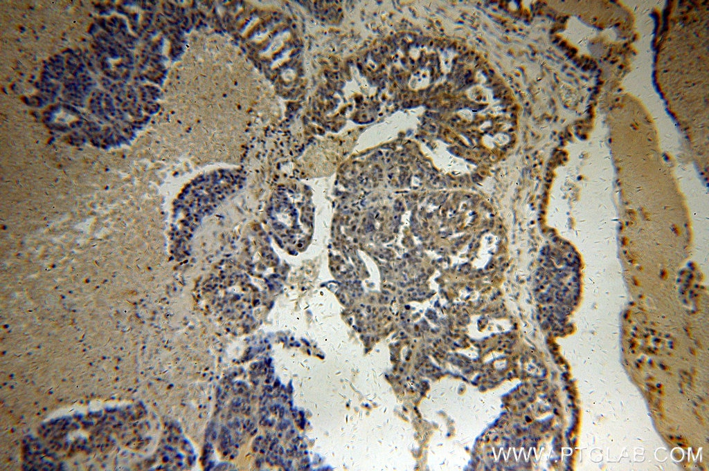 fus-tls-fusion-protein-ag2150-proteintech