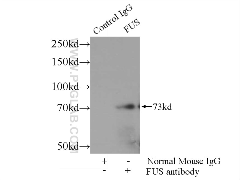 Immunoprecipitation (IP) experiment of HeLa cells using FUS/TLS Monoclonal antibody (60160-1-Ig)