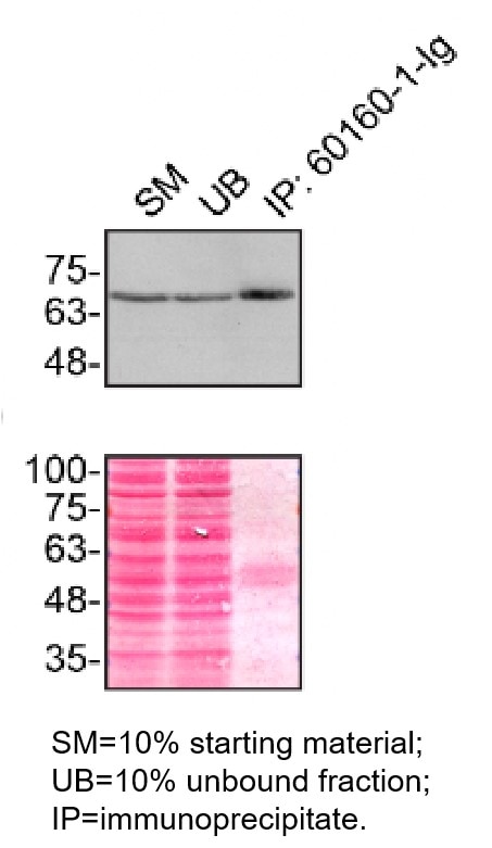 Immunoprecipitation (IP) experiment of HeLa cells using FUS/TLS Monoclonal antibody (60160-1-Ig)