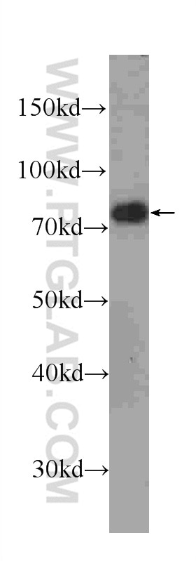 Western Blot (WB) analysis of HL-60 cells using FUS/TLS Monoclonal antibody (60160-1-Ig)