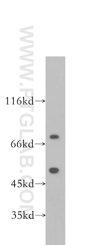 Western Blot (WB) analysis of HeLa cells using FUS/TLS Monoclonal antibody (60160-1-Ig)