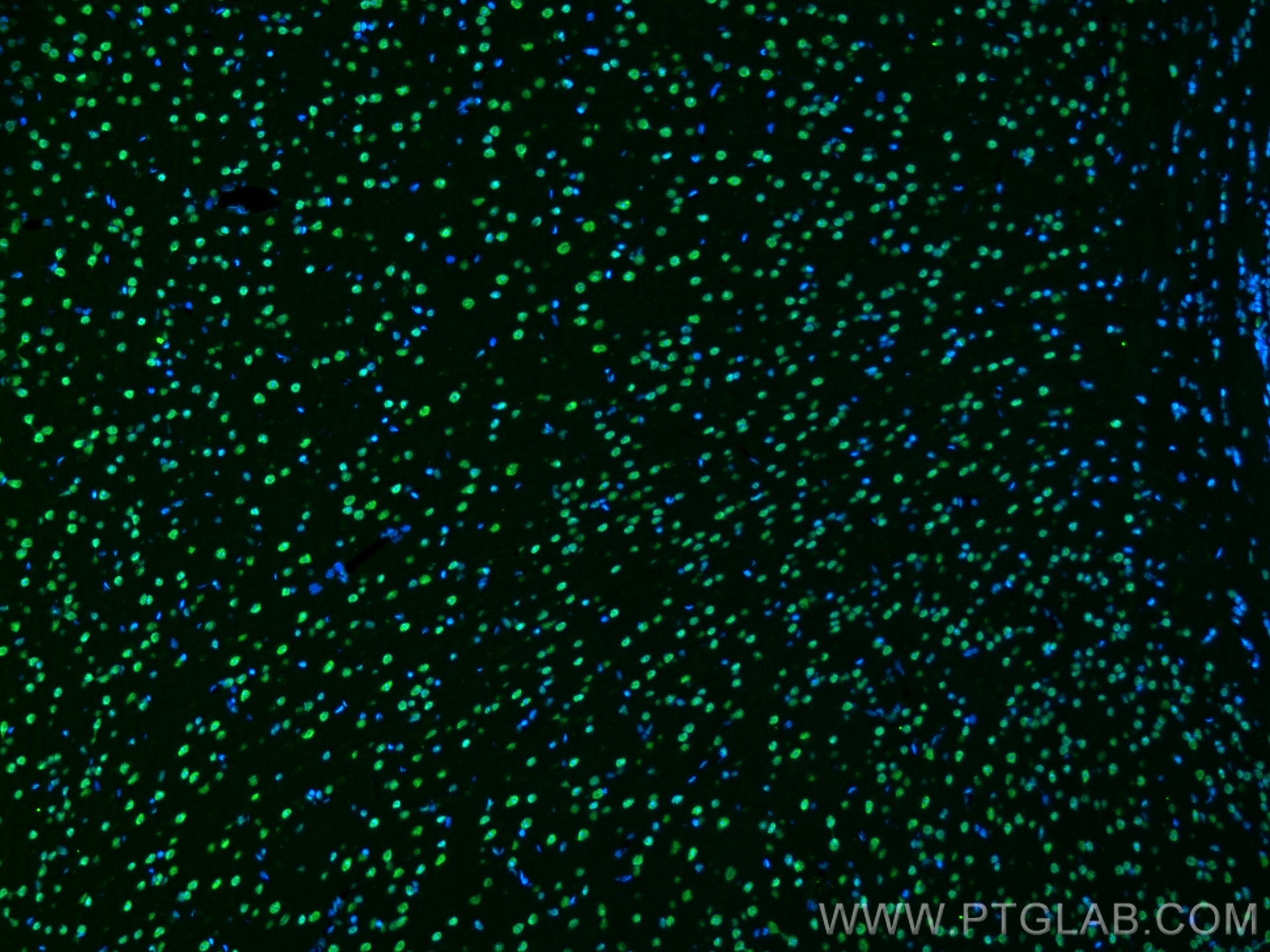 Immunofluorescence (IF) / fluorescent staining of mouse brain tissue using FUS/TLS Monoclonal antibody (68262-1-Ig)