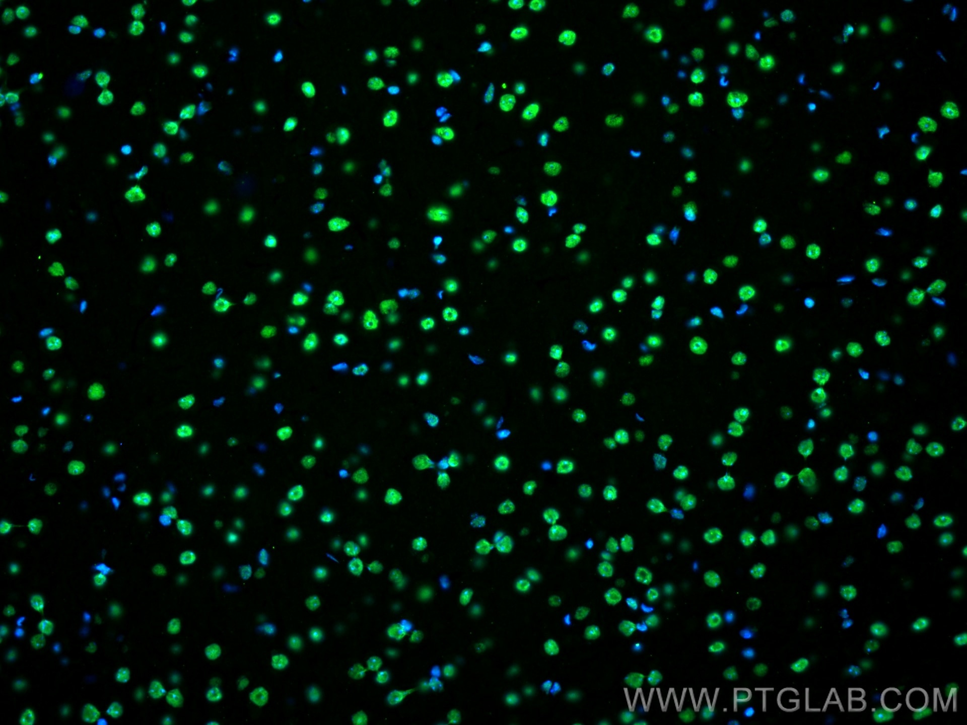 Immunofluorescence (IF) / fluorescent staining of mouse brain tissue using FUS/TLS Monoclonal antibody (68262-1-Ig)