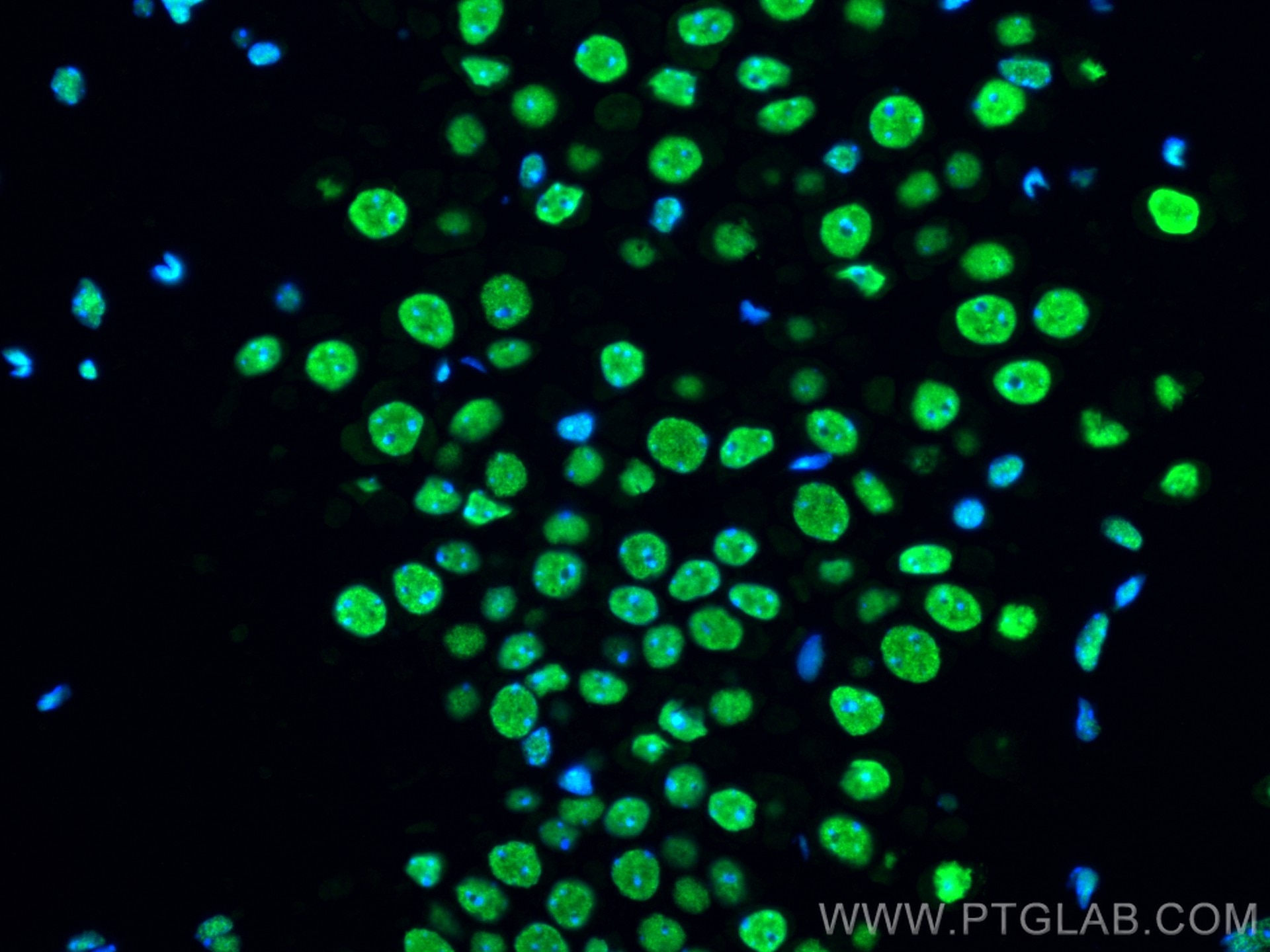 Immunofluorescence (IF) / fluorescent staining of mouse brain tissue using FUS/TLS Monoclonal antibody (68262-1-Ig)