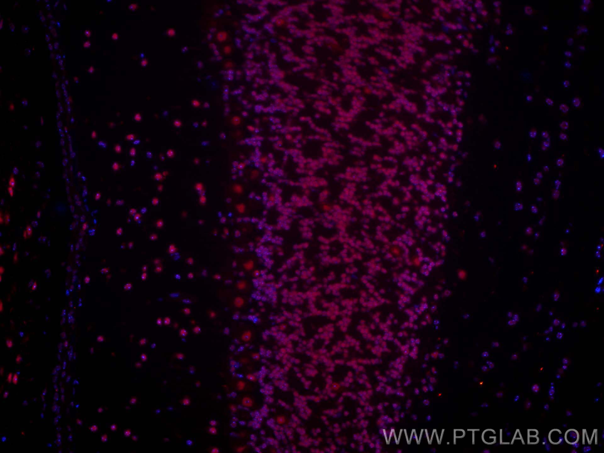 Immunofluorescence (IF) / fluorescent staining of mouse cerebellum tissue using FUS/TLS Monoclonal antibody (68262-1-Ig)