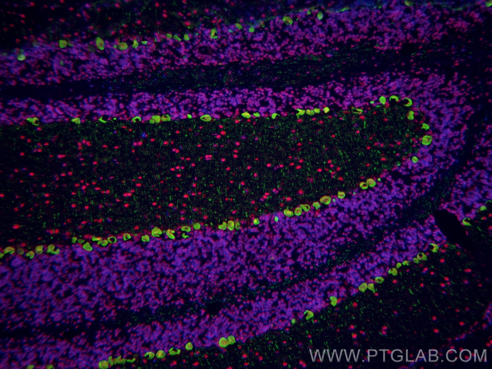 Immunofluorescence (IF) / fluorescent staining of mouse cerebellum tissue using FUS/TLS Monoclonal antibody (68262-1-Ig)