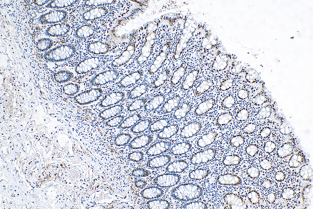 Immunohistochemistry (IHC) staining of human colon tissue using FUS/TLS Monoclonal antibody (68262-1-Ig)