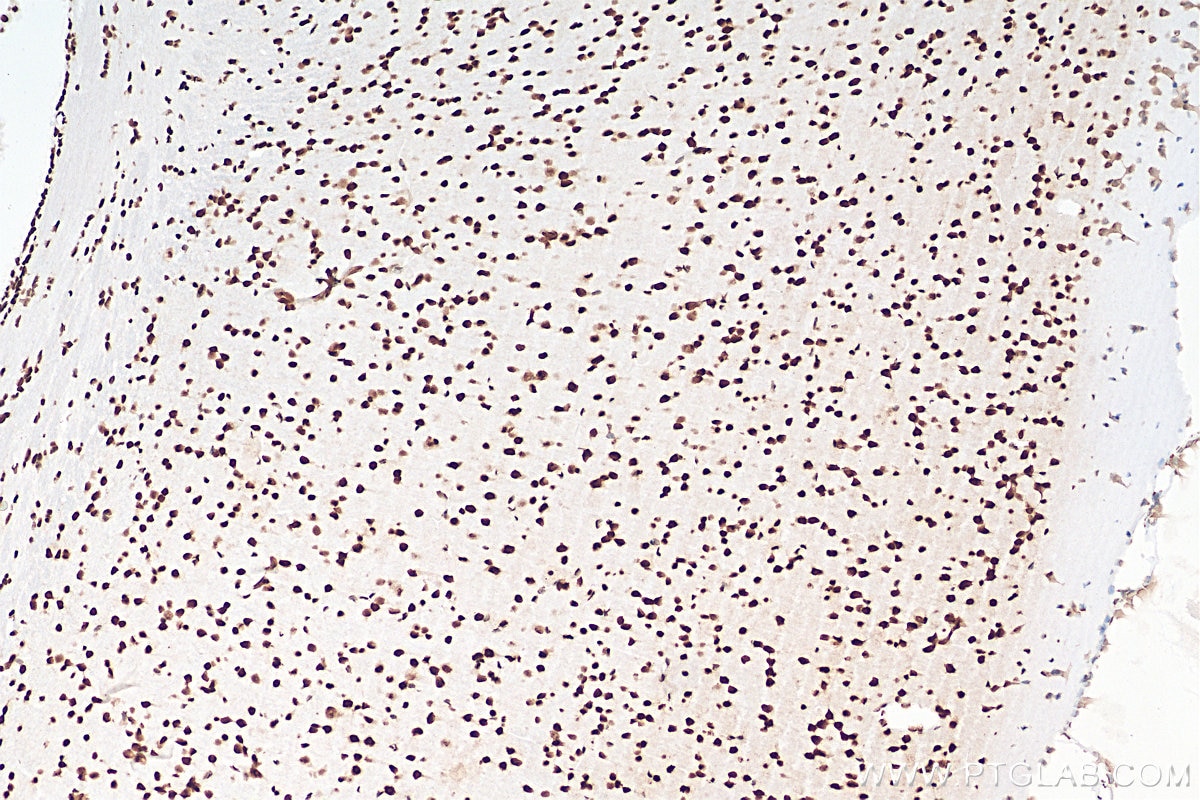 Immunohistochemistry (IHC) staining of mouse brain tissue using FUS/TLS Monoclonal antibody (68262-1-Ig)