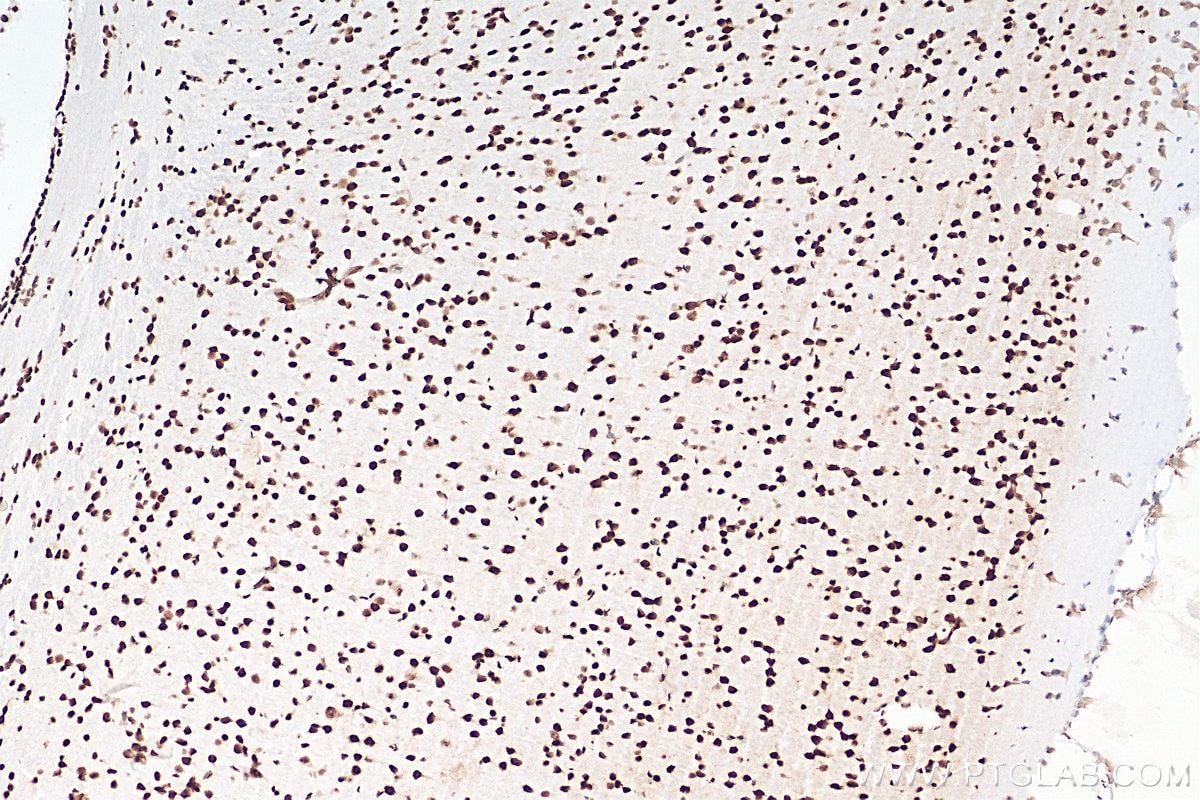 IHC staining of mouse brain using 68262-1-Ig