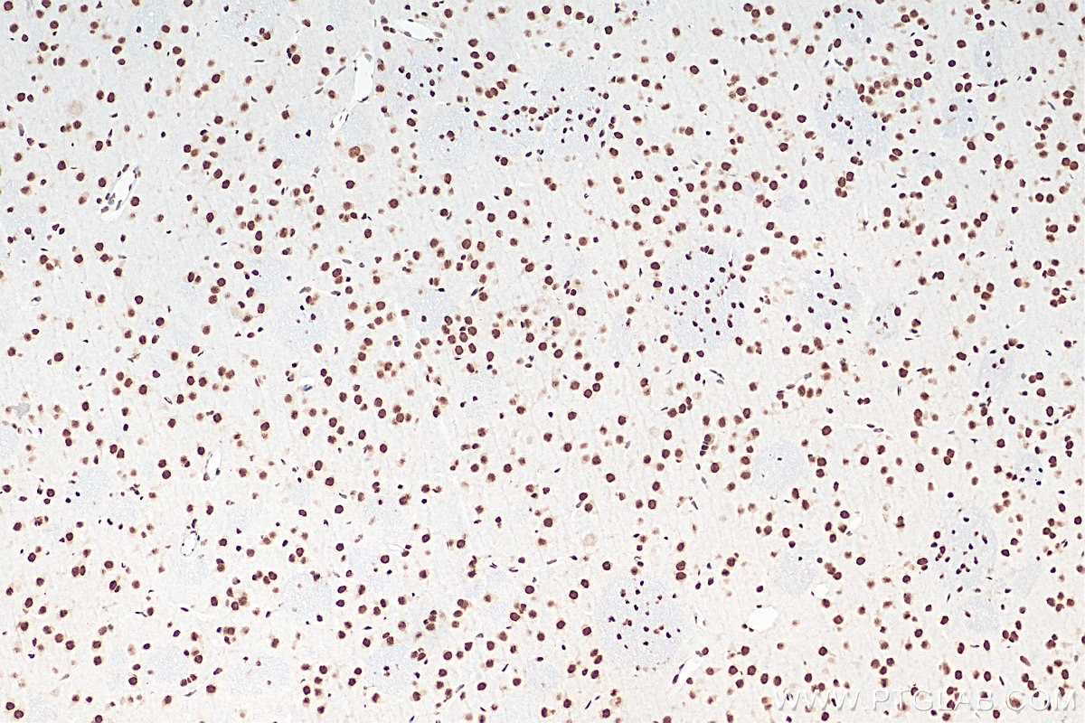 Immunohistochemistry (IHC) staining of rat brain tissue using FUS/TLS Monoclonal antibody (68262-1-Ig)