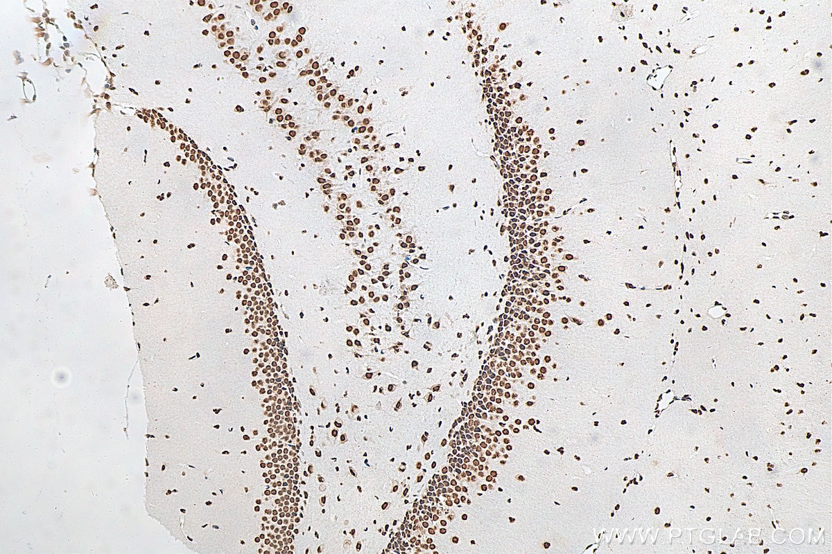 IHC staining of mouse brain using 68262-1-Ig