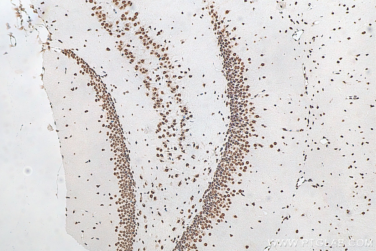 Immunohistochemistry (IHC) staining of mouse brain tissue using FUS/TLS Monoclonal antibody (68262-1-Ig)