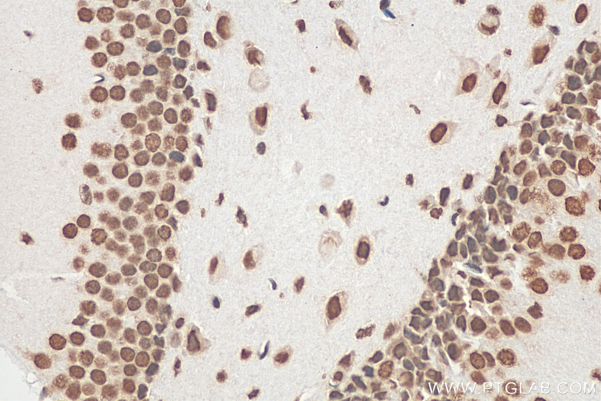 Immunohistochemistry (IHC) staining of mouse brain tissue using FUS/TLS Monoclonal antibody (68262-1-Ig)