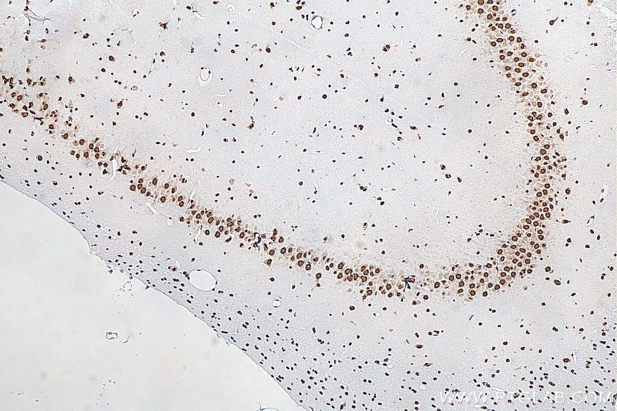 Immunohistochemistry (IHC) staining of rat brain tissue using FUS/TLS Monoclonal antibody (68262-1-Ig)