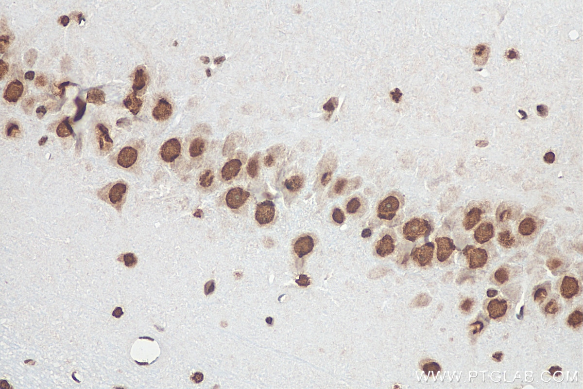 IHC staining of rat brain using 68262-1-Ig