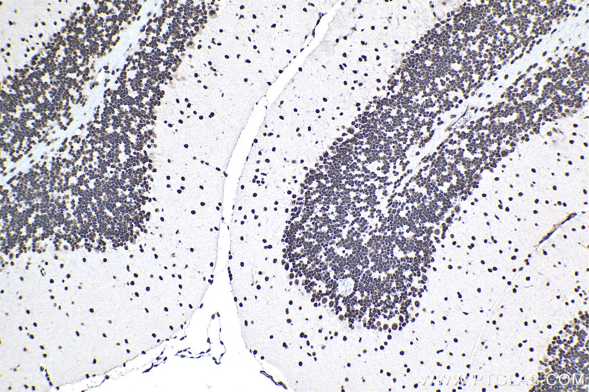 Immunohistochemistry (IHC) staining of mouse cerebellum tissue using FUS/TLS Monoclonal antibody (68262-1-Ig)