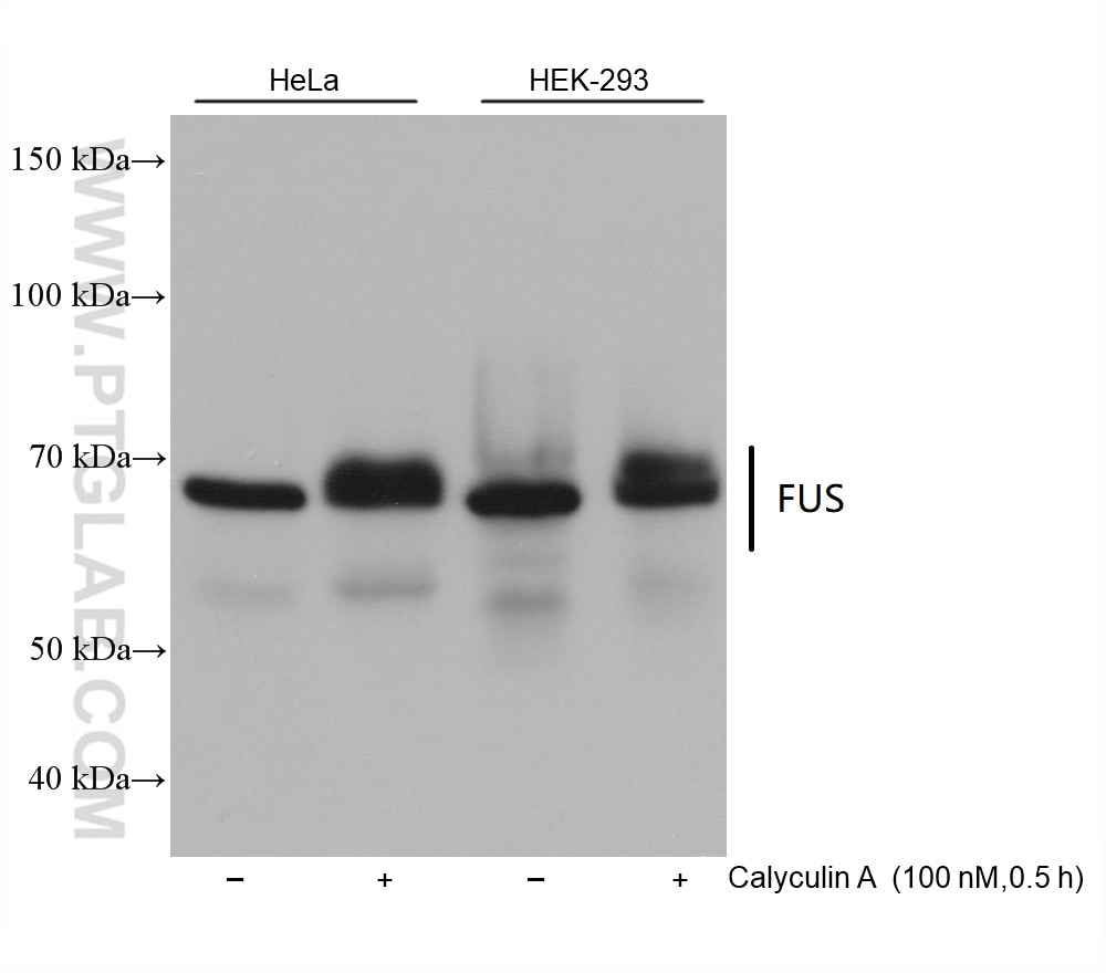 Western Blot (WB) analysis of various lysates using FUS/TLS Monoclonal antibody (68262-1-Ig)