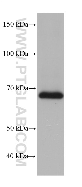 Western Blot (WB) analysis of Jurkat cells using FUS/TLS Monoclonal antibody (68262-1-Ig)