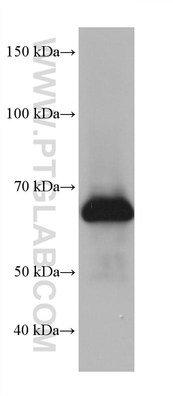 Western Blot (WB) analysis of Neuro-2a cells using FUS/TLS Monoclonal antibody (68262-1-Ig)