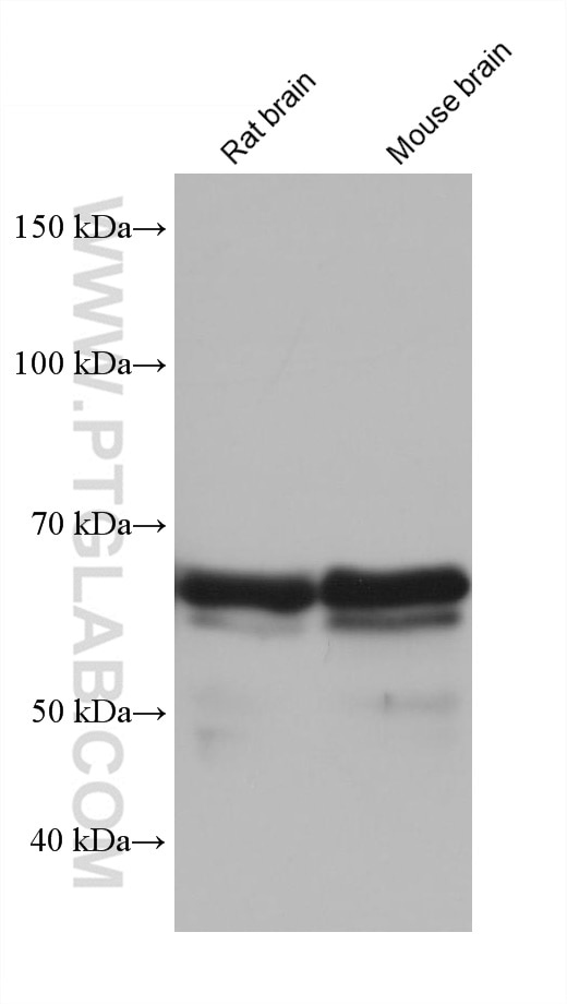 Western Blot (WB) analysis of various lysates using FUS/TLS Monoclonal antibody (68262-1-Ig)