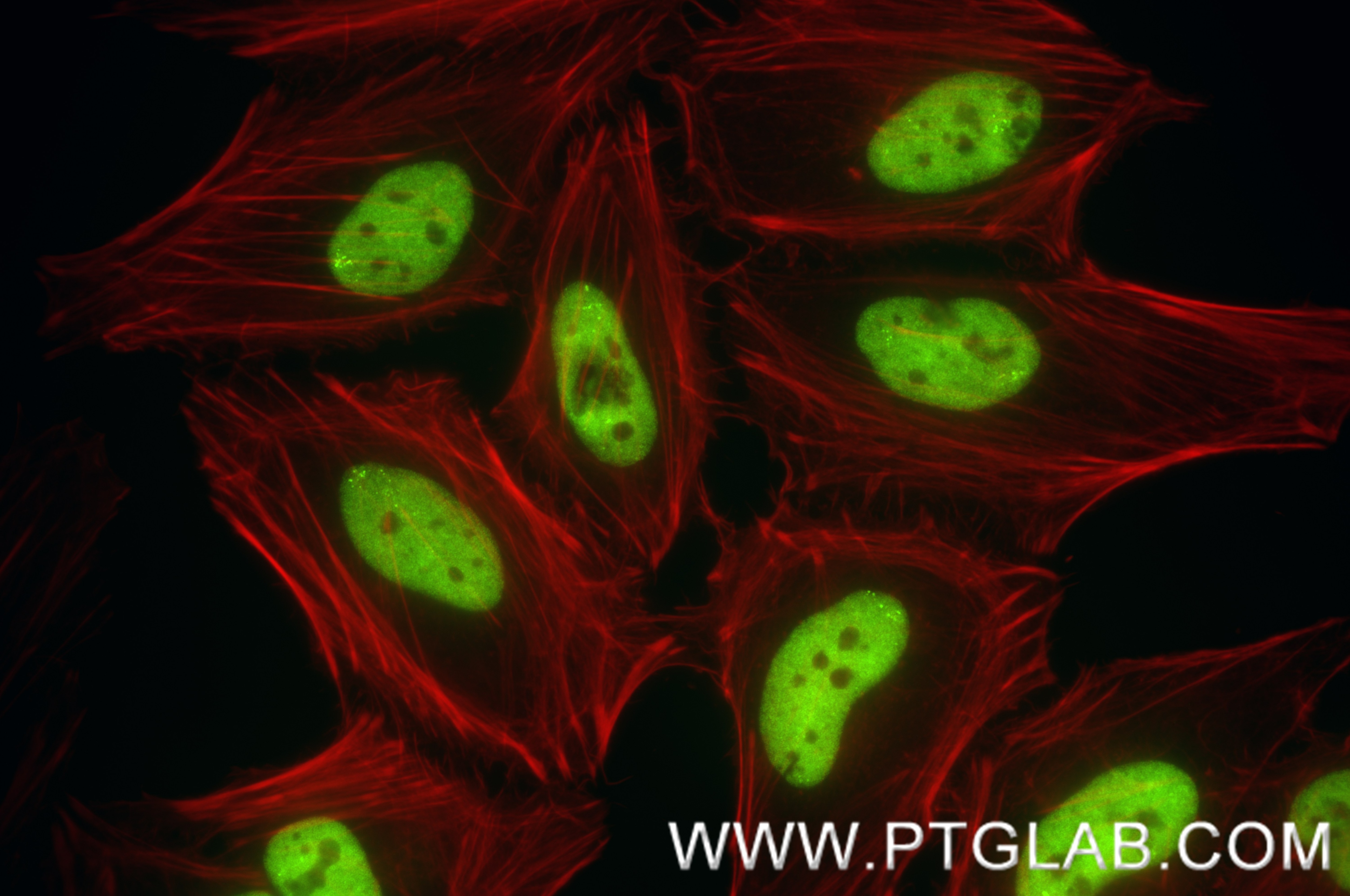 IF Staining of HeLa using 87839-1-RR (same clone as 87839-1-PBS) Immunofluorescence (IF) / fluorescent staining of HeLa cells using FUS/TLS Recombinant monoclonal antibody (87839-1-RR)