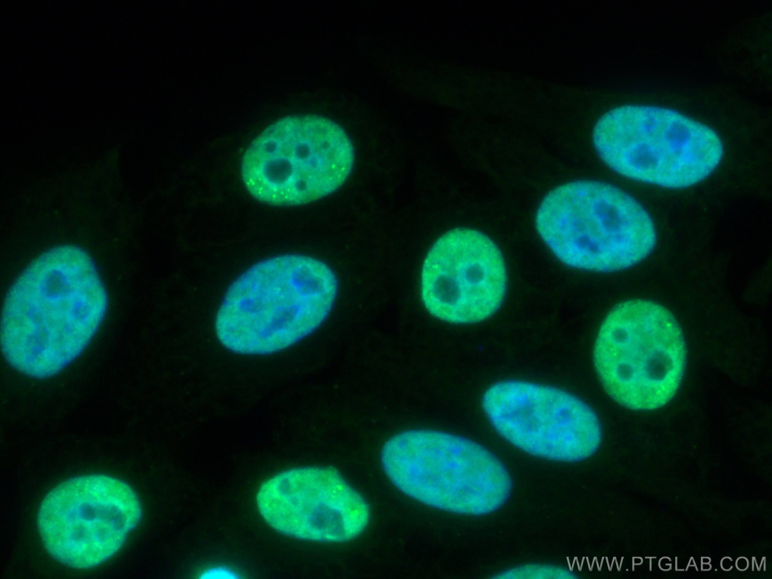 Immunofluorescence (IF) / fluorescent staining of HepG2 cells using CoraLite®488-conjugated FUS/TLS Polyclonal antibod (CL488-11570)