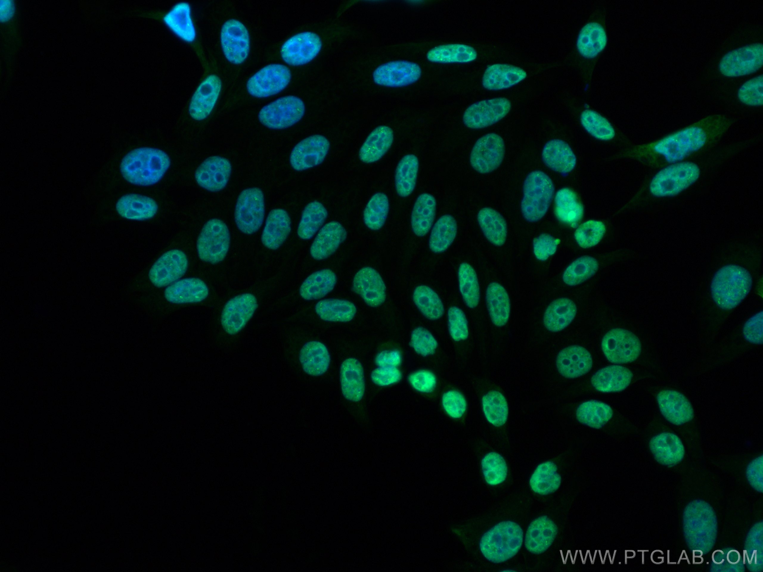 Immunofluorescence (IF) / fluorescent staining of HepG2 cells using CoraLite®488-conjugated FUS/TLS Polyclonal antibod (CL488-11570)