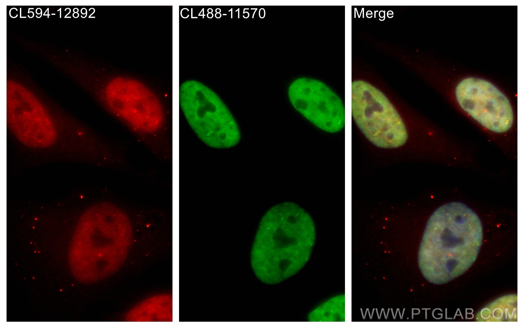 Immunofluorescence (IF) / fluorescent staining of HeLa cells using CoraLite®488-conjugated FUS/TLS Polyclonal antibod (CL488-11570)