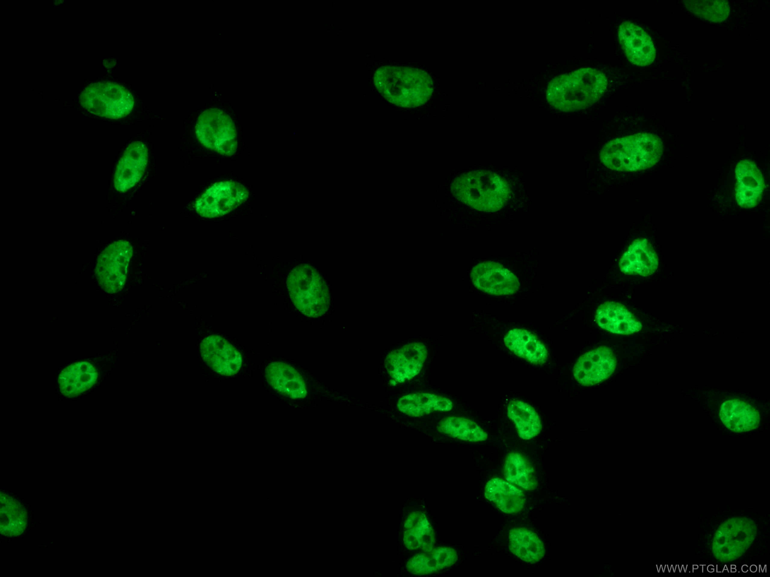 Immunofluorescence (IF) / fluorescent staining of HeLa cells using CoraLite® Plus 488-conjugated FUS/TLS Monoclonal a (CL488-60160)