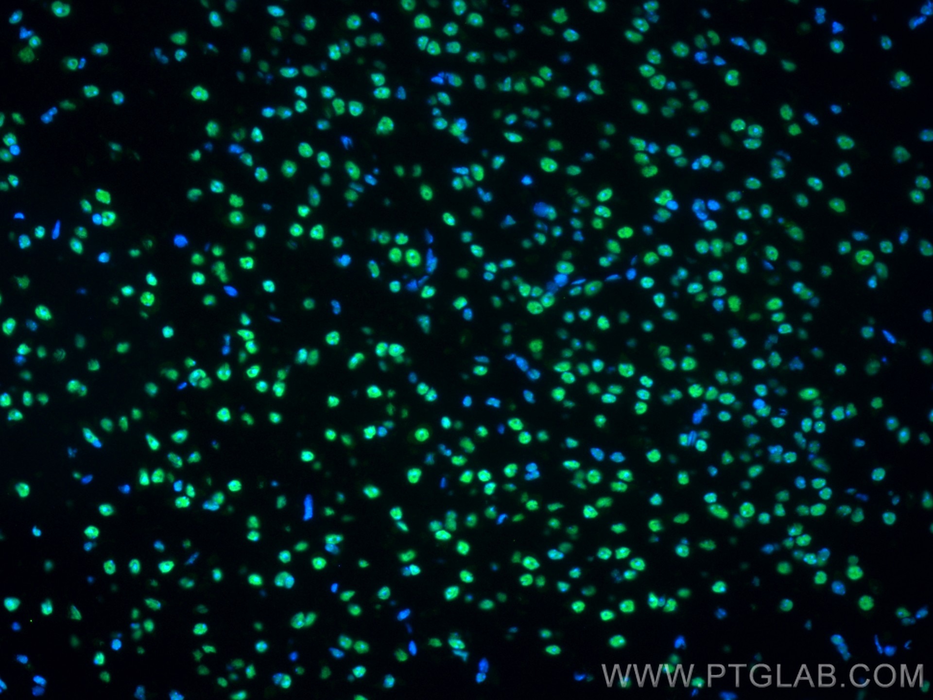 Immunofluorescence (IF) / fluorescent staining of mouse brain tissue using CoraLite® Plus 488-conjugated FUS/TLS Monoclonal a (CL488-68262)