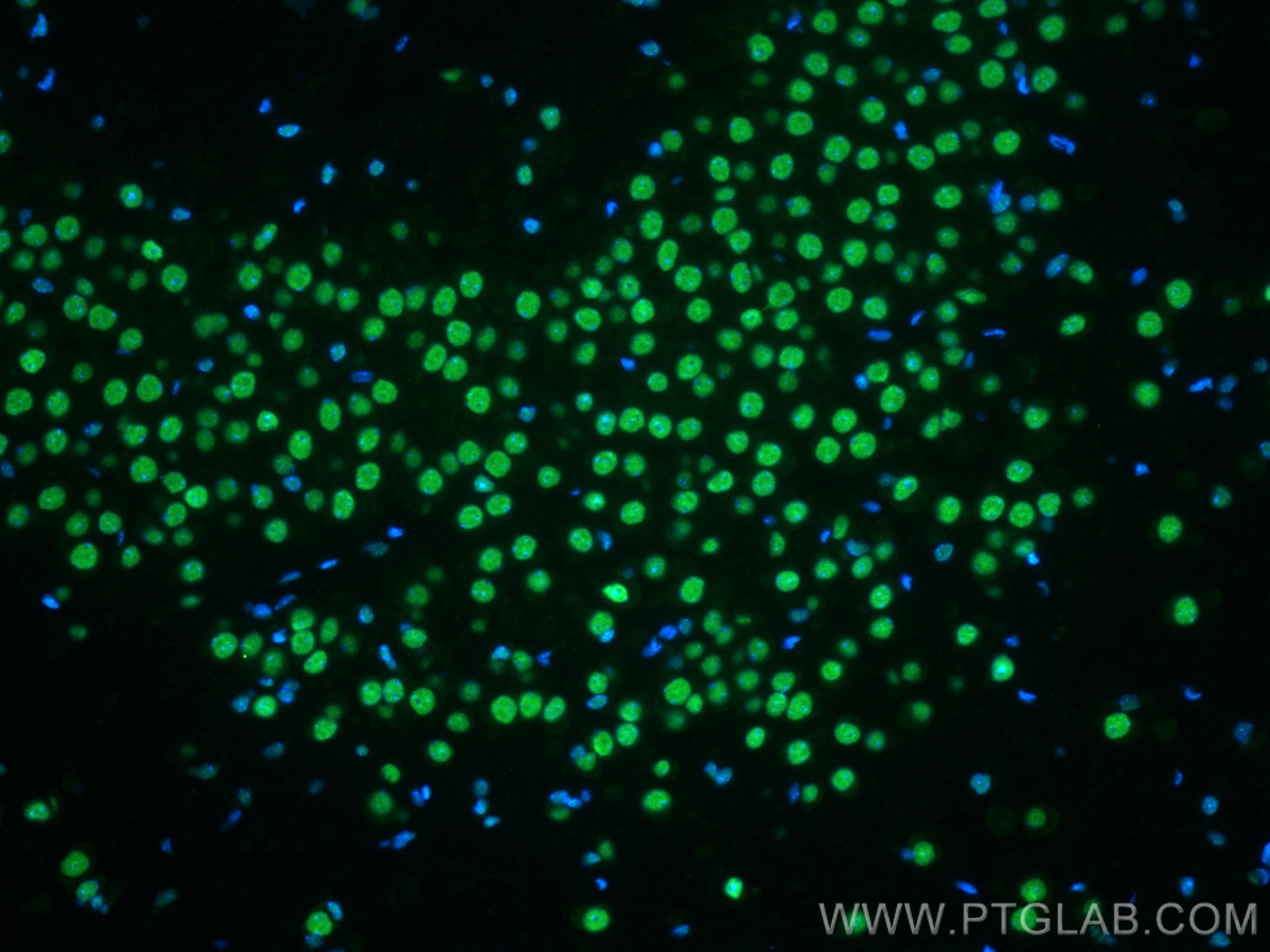 Immunofluorescence (IF) / fluorescent staining of mouse brain tissue using CoraLite® Plus 488-conjugated FUS/TLS Monoclonal a (CL488-68262)