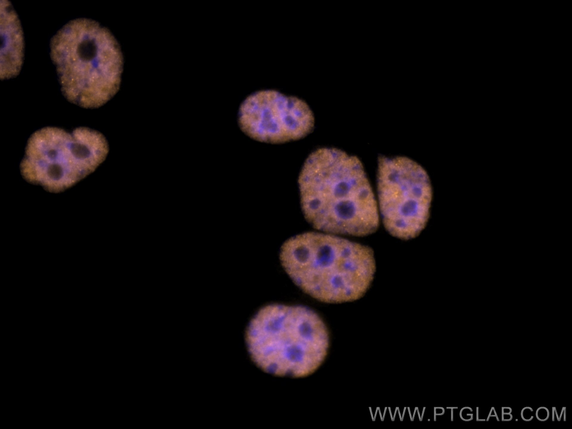 Immunofluorescence (IF) / fluorescent staining of MCF-7 cells using CoraLite®555-conjugated FUS/TLS Polyclonal antibod (CL555-11570)