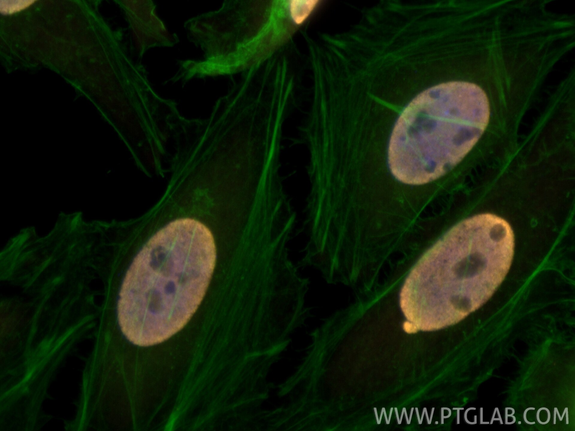 Immunofluorescence (IF) / fluorescent staining of HeLa cells using CoraLite®555-conjugated FUS/TLS Polyclonal antibod (CL555-11570)