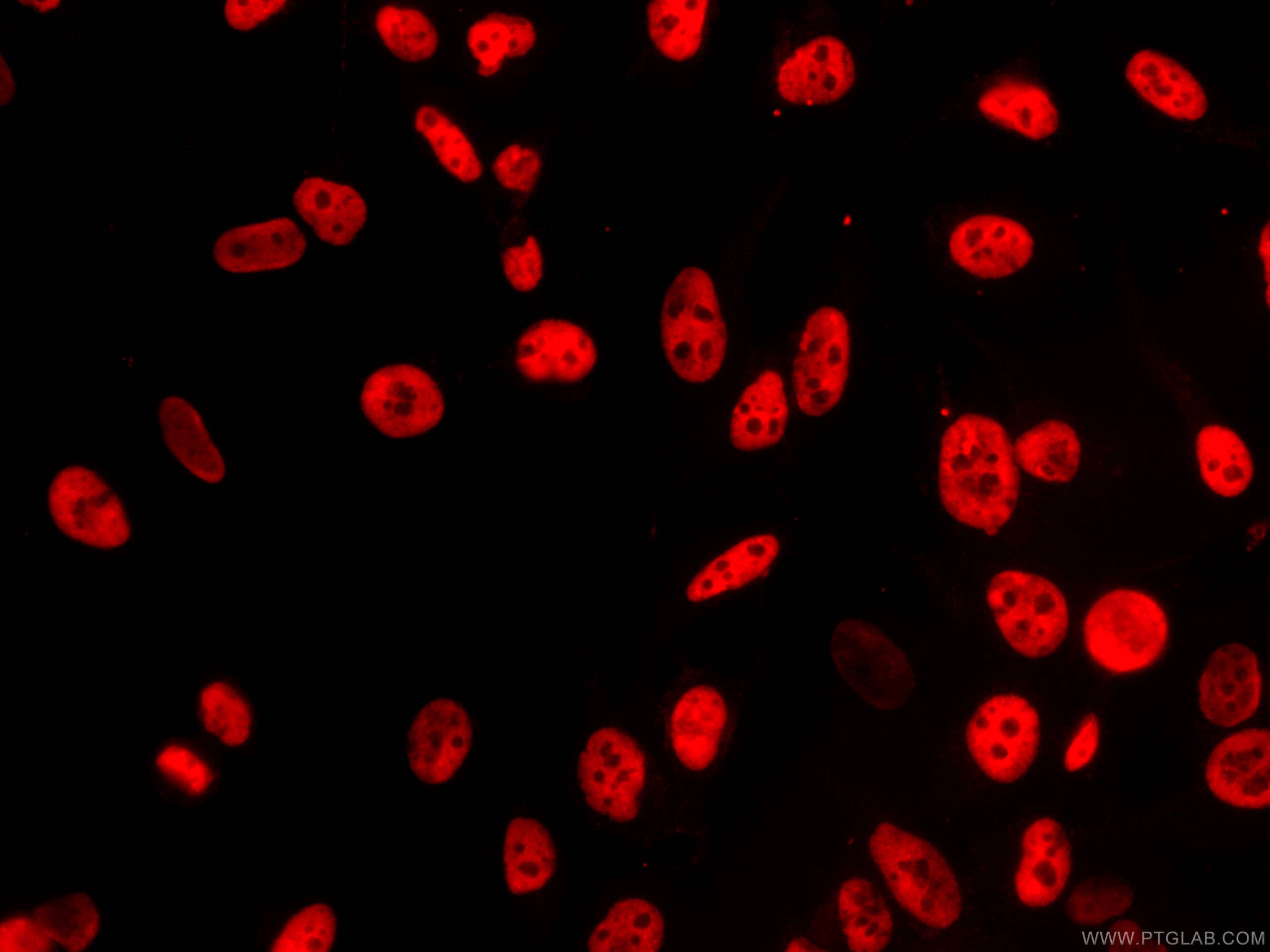 Immunofluorescence (IF) / fluorescent staining of HeLa cells using CoraLite®594-conjugated FUS/TLS Monoclonal antibod (CL594-60160)