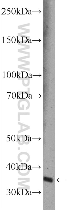 WB analysis of HepG2 using 10131-1-AP